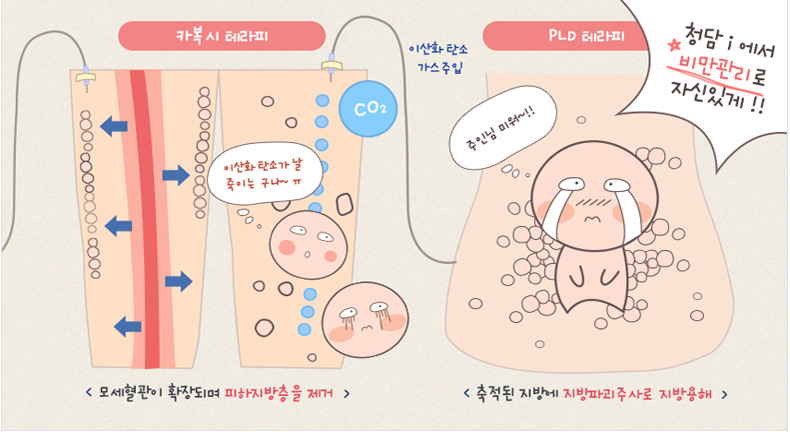 카복시테라피의 원리
