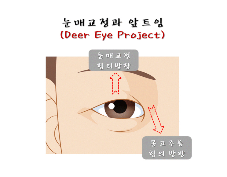 chungdami_eye_deer eye project_03