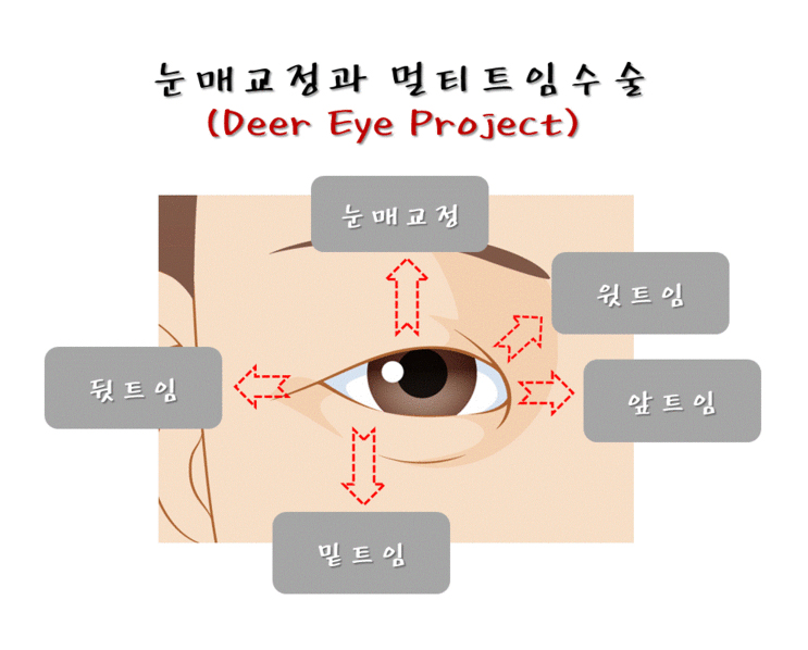 chungdami_eye_deer eye project_04