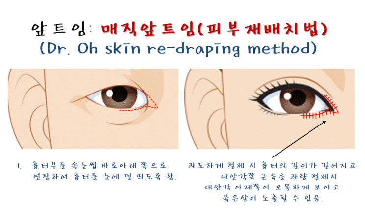 chungdami_eye_oh skin re-draping method_01