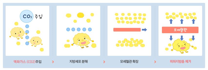 카복시 과정 카복시 과정