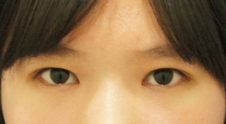 유나의 예쁜 눈의 비밀!